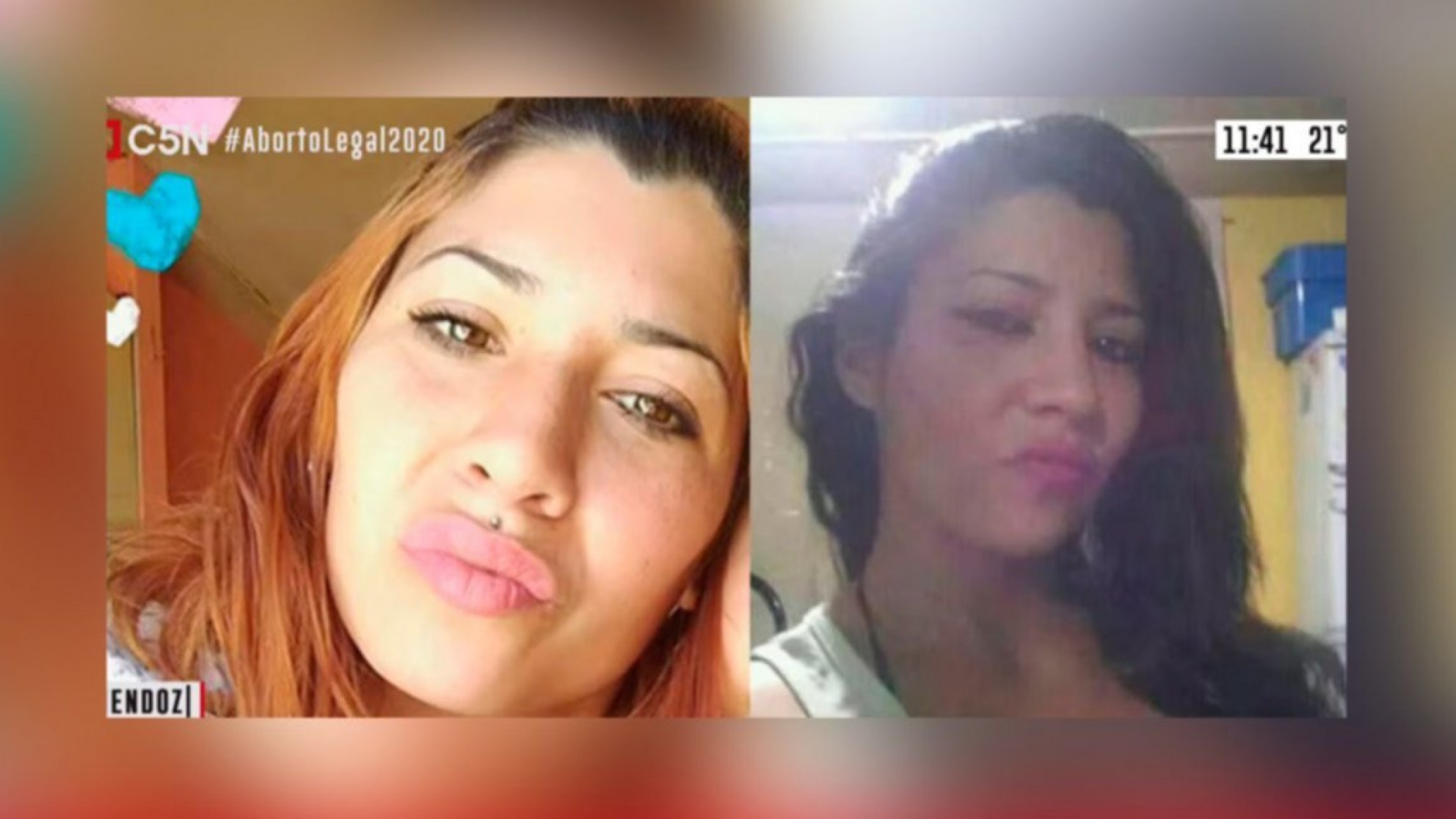Las Heras: por celos, prendió fuego a su ex y su nueva pareja